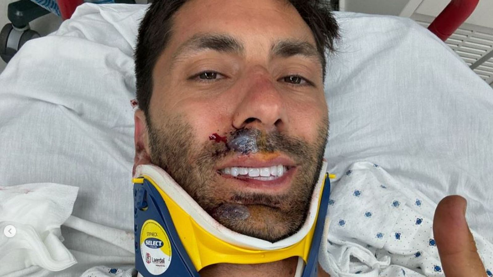 Catfish Star Breaks Neck in Bike Crash, Thanks Doctors for "Incredible" Care